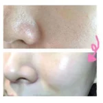 اسکراب لایه بردار صورت و بدن بیواکوا - تصویر 2